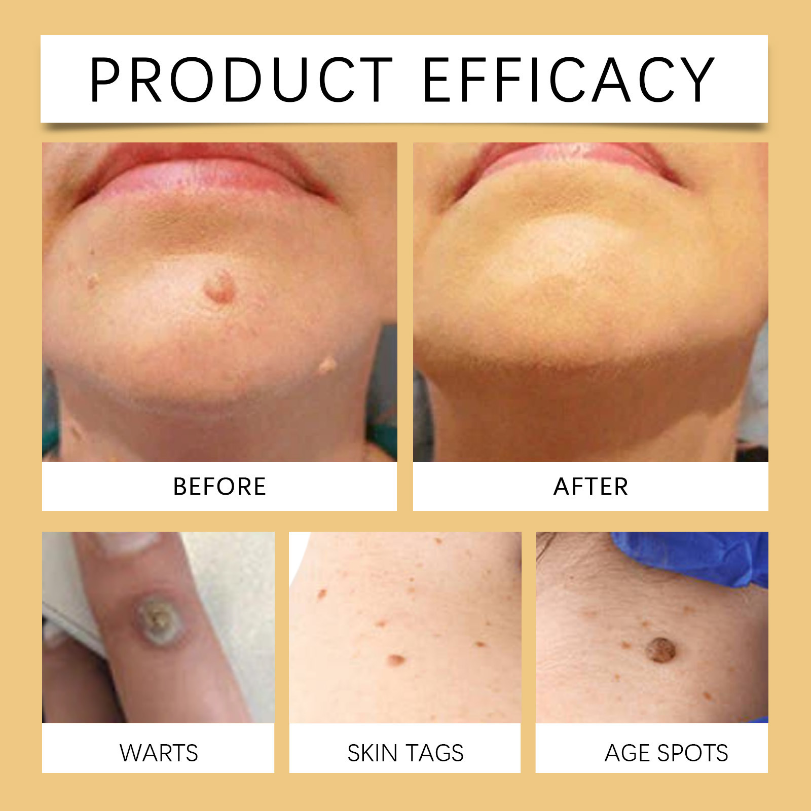 Herbal Mild Fade Skin Mole Skin Cleaning Care Cream - Image 5